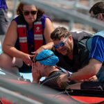 Top triathlete called an ‘absolute warrior’ after moving dislocated shoulder back DURING swim