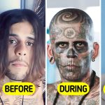 Man Who Was 95% Tattooed Shows Shocking Transformation After Laser Removal Surgery