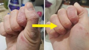 32 Hydrating Products To Start Using *Before* Your Skin Feels Scaly And Your Lips Get Chapped