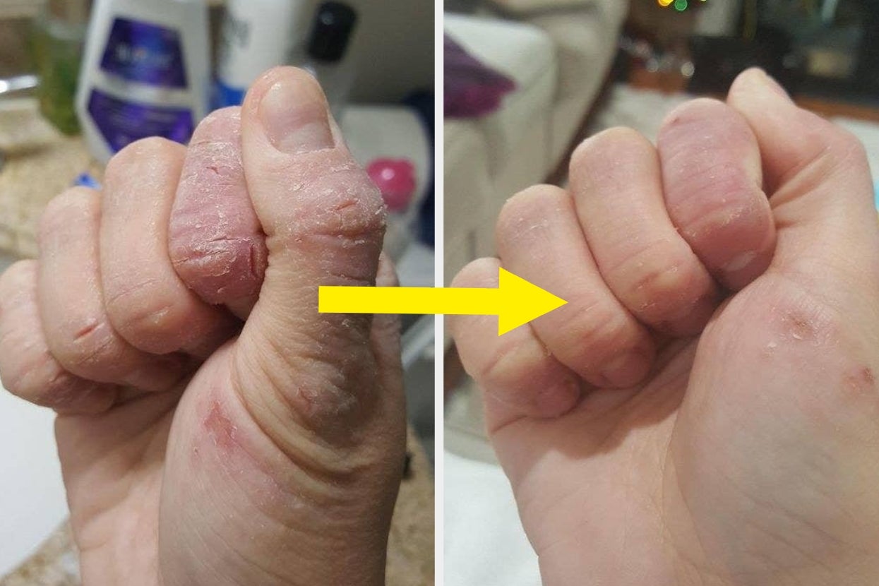 32 Hydrating Products To Start Using *Before* Your Skin Feels Scaly And Your Lips Get Chapped